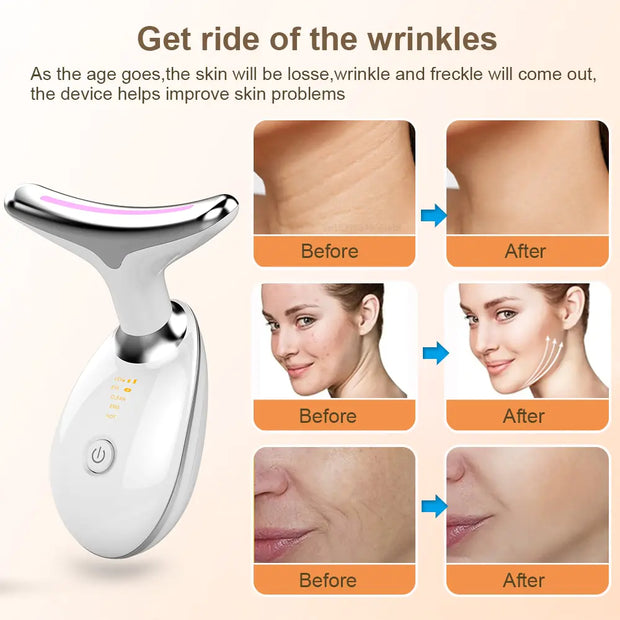 Neck Face Lifting Beauty Device - 3 Million LLC