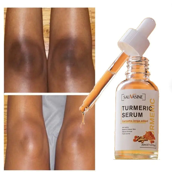 Natural Glow Serum: Turmeric Infused Skincare Solution - 3 Million LLC